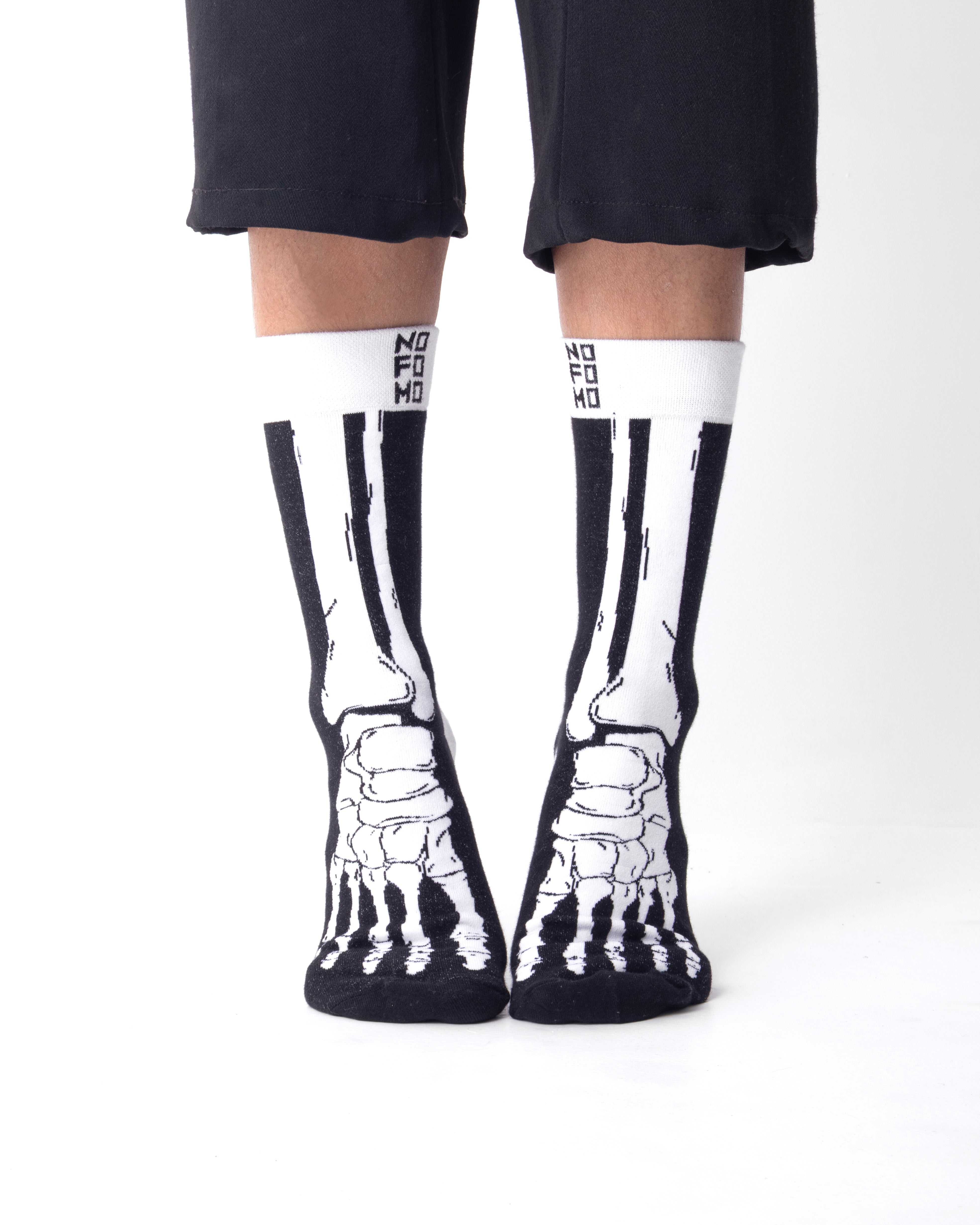 No Fomo X-ray